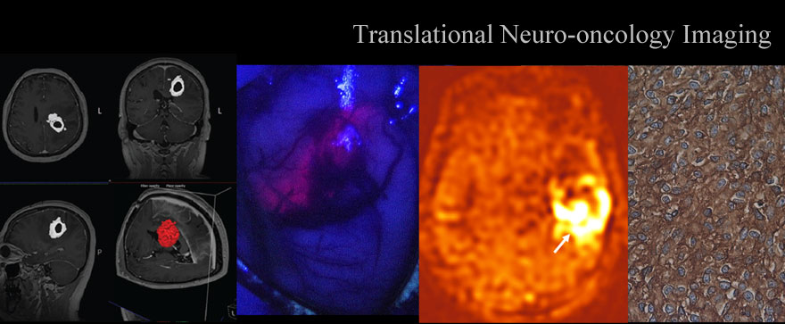 Translational Neuro-oncology Imaging