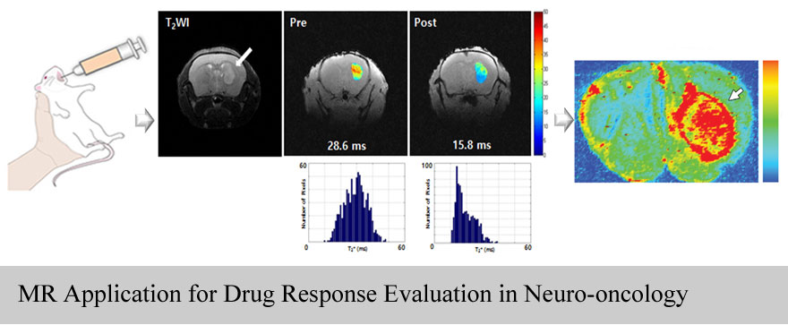 MR Application for Drug Response Evaluation in Neuro-oncology