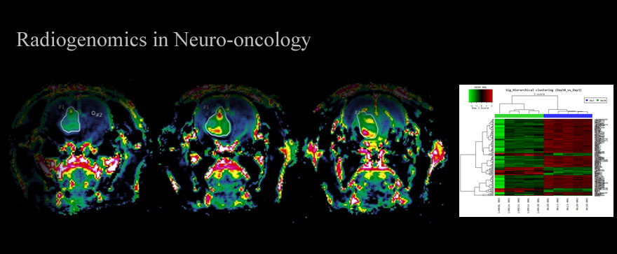 Radiogenomics in Neuro-oncology
